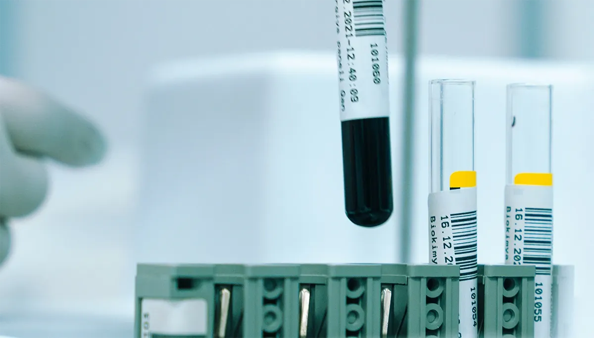 Diagnostics